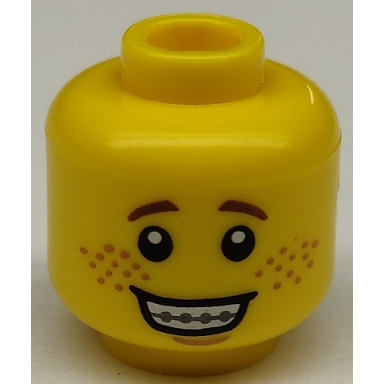 yellow minifigure head open mouth smile with teeth and braces freckles pattern